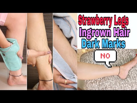 Remove 🍓STRAWBERRY LEGS in 1 Week |Waxing/Shaving Tips | Super Style Tips