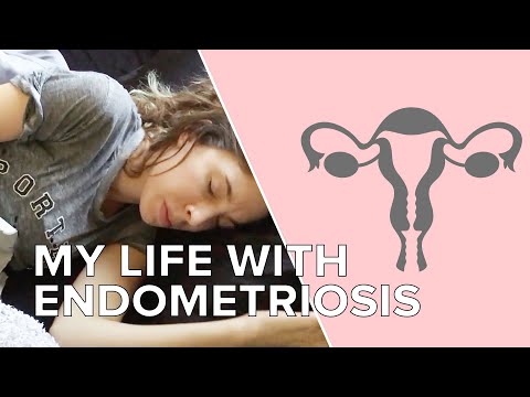 A Week In My Life With Endometriosis